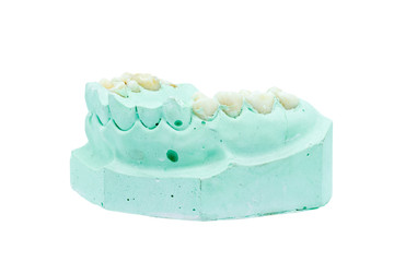 Denture cast model