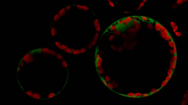 Arabidopsis protoplasts