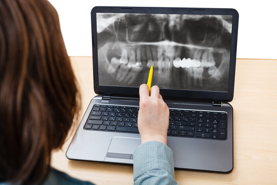 student analyzes X-ray picture of jaws on laptop