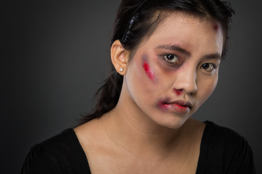 Asian woman victim of domestic abuse