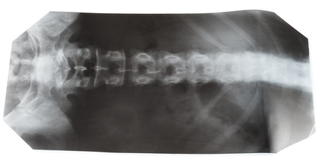 X-ray photo of human spinal column isolated