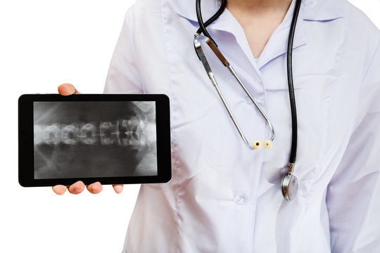 nurse holds tablet pc with human spinal column