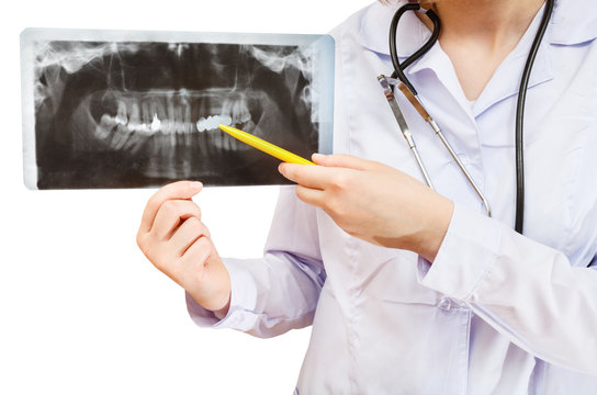 nurse points on X-ray picture with human jaw