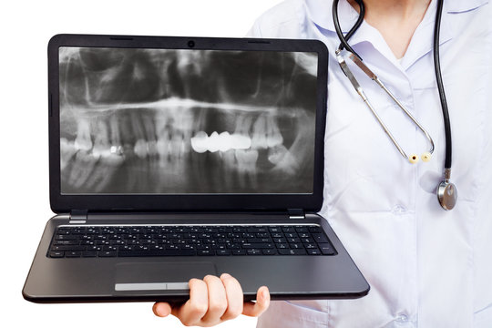 nurse holds computer laptop with human jaw