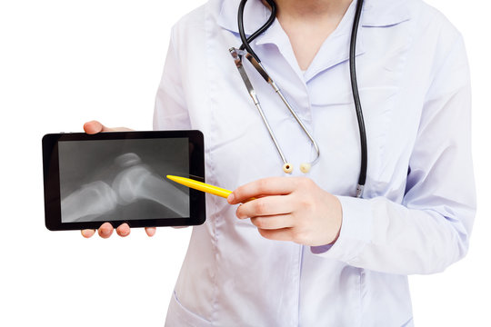 nurse points on tablet pc with human knee joint