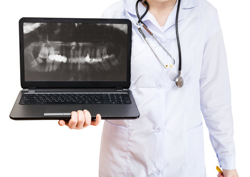nurse holds computer laptop with human teeth