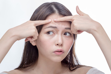 Fototapeta premium Asian woman squeezing spot on forehead