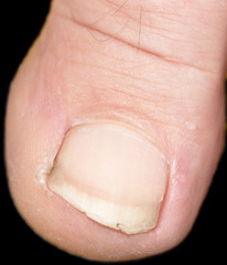 toes