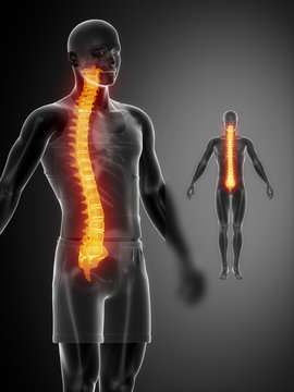 SPINE black x--ray bone scan