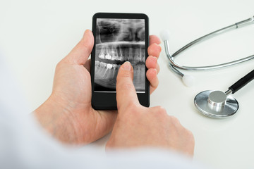Person With Dental X-ray Film On Mobile Phone