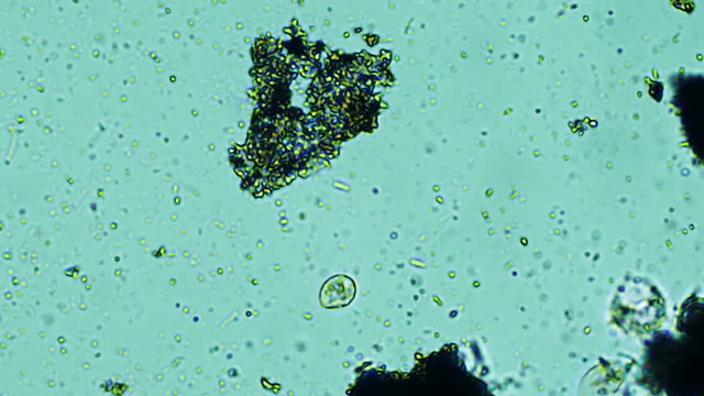 Swimming Protozoan Microscope View 800x