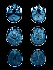 mri scan © gmstockstudio