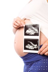 Pregnant woman showing ultrasound scans