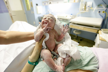 Vernix covered newborn after delivery - 81867303