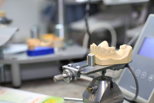 Denture cast in plaster for the dentist