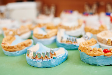 dental prosthesis equipment