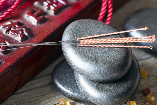 Traditionelle chinesische Medizin, Akkupunktur