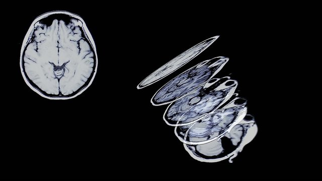 brain scan slices animation in black background