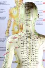 weibliches Akupunkturmodell mit Nadeln im Schulterbereich vor Lehrtafel