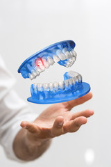 dentis