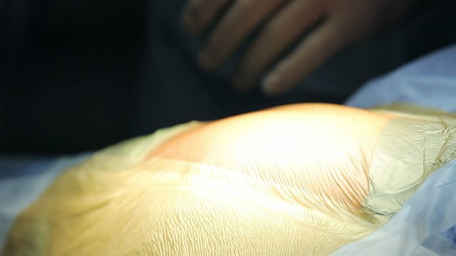 Surgery site