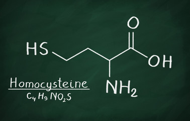 Chemical formula of Homocysteine on a blackboard