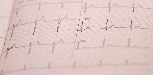 Naklejka premium Electrocardiogram close-up