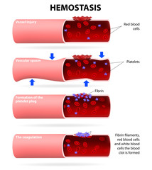 Basic steps in hemostasis