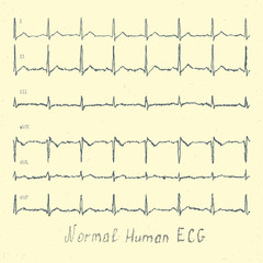 Normal human ECG hand-drawn vector