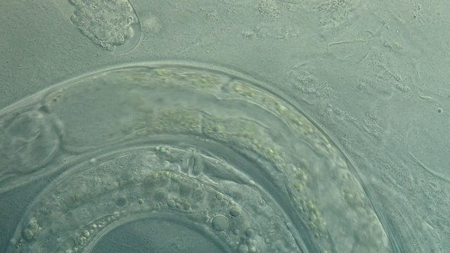 A free-living, transparent nematode (roundworm)