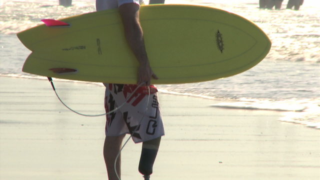 amputee surfer on the beach