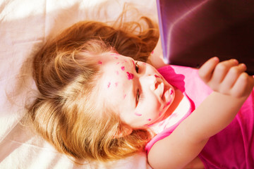 Ill little girl playing on a tablet