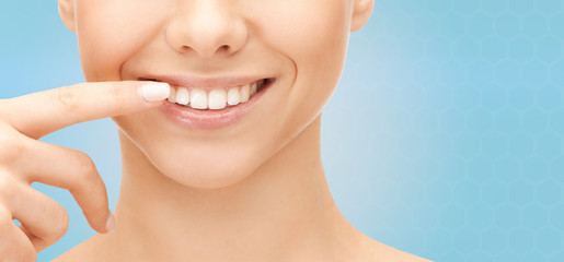 close up of smiling woman face pointing to teeth