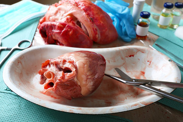 Heart organ in medical metal tray with tools on table, closeup