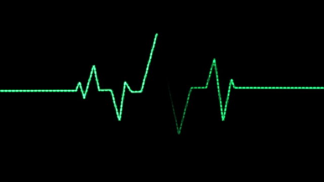 Heart Rate Monitor (24fps). A loopable animation blip of a heart beat being displayed by a green Electrocardiogram (EKG or ECG).
