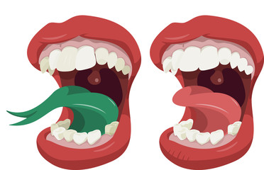 Big mouth