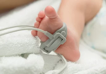 Fotobehang Pulse oximeter sensor on a baby foot © praisaeng