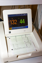 monitor for measuring of labor contractions