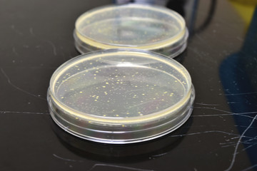 Many petri dishes with culture medium in laboratory.