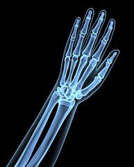 x-ray image of a man isolated on black