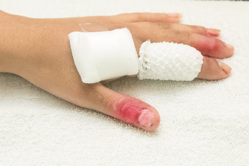  injured finger wrapped in a gauze bandage