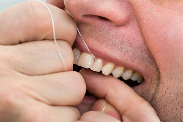 Man Flossing Teeth