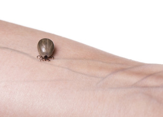 Tick on a skin