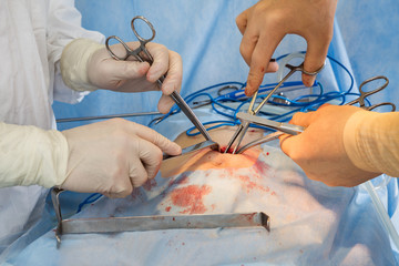 surgery on the abdomen