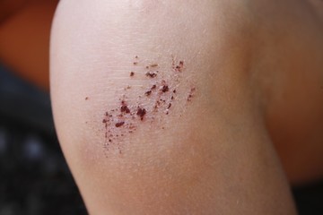 Fototapeta premium Bobo d'enfant