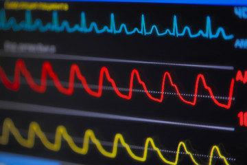 Waves ECG on monitor in perspective