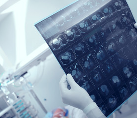 Medical doctor research CT scan of heavy patient in hospital;