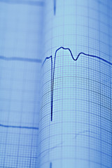 ECG macro as a medical diagnostic concepts