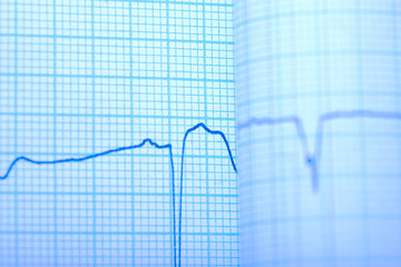 Seismograph draw on the grid paper