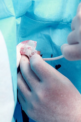 Doctor conducting the procedure with hands close-up concept work